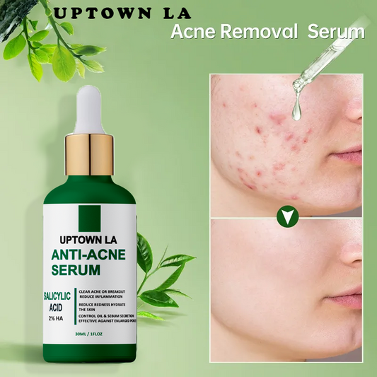 Anti Acne Serum